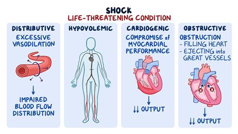 Hypovolemic and septic Shock 